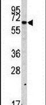 SWAP70 Antibody in Western Blot (WB)