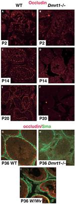 Occludin Antibody in Immunohistochemistry (Paraffin) (IHC (P))