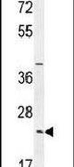 SYCE2 Antibody in Western Blot (WB)