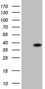 SYCP3 Antibody in Western Blot (WB)