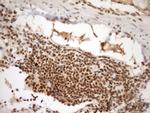 SYF2 Antibody in Immunohistochemistry (Paraffin) (IHC (P))