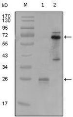 SLC22A1 Monoclonal Antibody (8C1A3)
