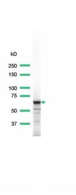 Syk Antibody in Western Blot (WB)