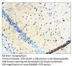 Synaptophysin Antibody in Immunohistochemistry (IHC)