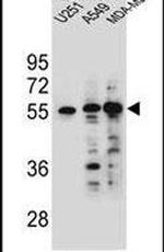 SYNC Antibody in Western Blot (WB)