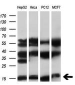 SYNJ2BP Antibody in Western Blot (WB)