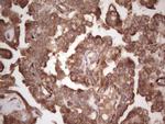 SYNM Antibody in Immunohistochemistry (Paraffin) (IHC (P))