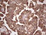SYNM Antibody in Immunohistochemistry (Paraffin) (IHC (P))