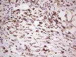 SYNM Antibody in Immunohistochemistry (Paraffin) (IHC (P))