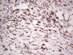 SYNM Antibody in Immunohistochemistry (Paraffin) (IHC (P))