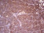 SYNM Antibody in Immunohistochemistry (Paraffin) (IHC (P))