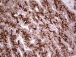 SYNM Antibody in Immunohistochemistry (Paraffin) (IHC (P))