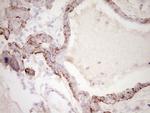 SYNM Antibody in Immunohistochemistry (Paraffin) (IHC (P))