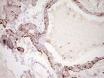 SYNM Antibody in Immunohistochemistry (Paraffin) (IHC (P))