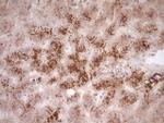 SYNM Antibody in Immunohistochemistry (Paraffin) (IHC (P))