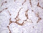 SYNM Antibody in Immunohistochemistry (Paraffin) (IHC (P))