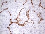 SYNM Antibody in Immunohistochemistry (Paraffin) (IHC (P))