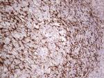 SYNM Antibody in Immunohistochemistry (Paraffin) (IHC (P))