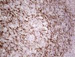 SYNM Antibody in Immunohistochemistry (Paraffin) (IHC (P))