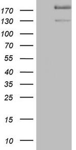 SYNM Antibody in Western Blot (WB)