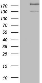 SYNM Antibody in Western Blot (WB)