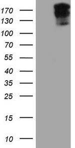 SYNM Antibody in Western Blot (WB)