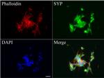 SYP Antibody in Immunocytochemistry (ICC/IF)