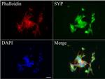 SYP Antibody in Immunocytochemistry (ICC/IF)