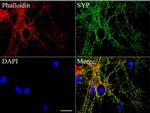 SYP Antibody in Immunocytochemistry (ICC/IF)