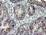 SYP Antibody in Immunohistochemistry (Paraffin) (IHC (P))