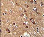SYT13 Antibody in Immunohistochemistry (IHC)