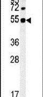 SYT13 Antibody in Western Blot (WB)