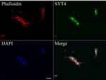 SYT4 Antibody in Immunocytochemistry (ICC/IF)
