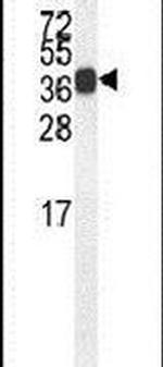Synaptotagmin 8 Antibody in Western Blot (WB)