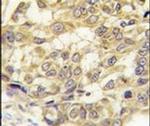 SEMA3E Antibody in Immunohistochemistry (IHC)