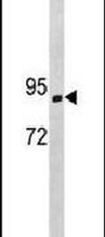 SEMA3E Antibody in Western Blot (WB)