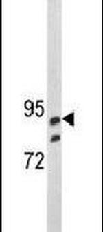 SEMA3E Antibody in Western Blot (WB)