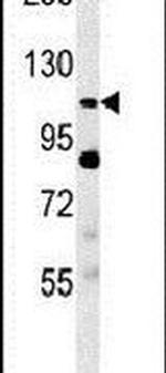 SEMA5A Antibody in Western Blot (WB)