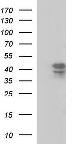Septin 1 Antibody in Western Blot (WB)