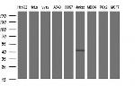 Septin 1 Antibody in Western Blot (WB)
