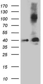 Septin 3 Antibody in Western Blot (WB)