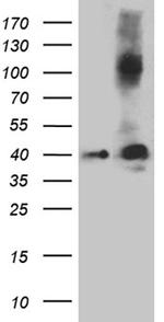 Septin 3 Antibody in Western Blot (WB)