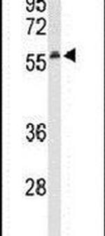 SESN1 Antibody in Western Blot (WB)