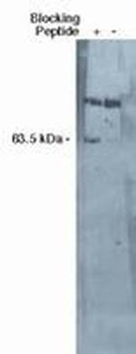 SGPL1 Polyclonal Antibody