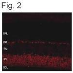 SHANK1 Polyclonal Antibody