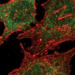 SMAD2 Monoclonal Antibody (R.542.9)