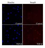 Smad4 Antibody in Immunocytochemistry (ICC/IF)