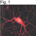 SNAP25 Polyclonal Antibody
