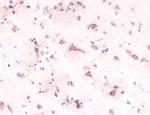 SCN1A Antibody in Immunohistochemistry (IHC)