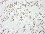 Sp1 Antibody in Immunohistochemistry (IHC)